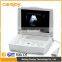 Hospital clinical equipment 15-inch full digital Laptop Ultrasound Scanner China made portable ultrasound machine