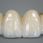 Multilayer High Translucent Zirconia