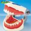 2015 hot sale typodont dental study teeth model with removable screw for training