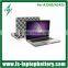 2016 Newest OEM Case for Macbook 13 Retina, Laptop Hard Case for Macbook Notebook Case Cover