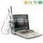 MY-A040B High quality focused physiotherapy therapeutic ultrasound portable ultrasound therapy machines