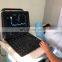 MY-A032A medical sonography machine cardiac full digital 4D color doppler ultrasound portable mobile
