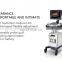 Mindray DC-30 Ultrasound Equipment/Mindray Color Doppler Ultrasound