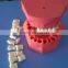 (32 Teeth) cavity preparation cavity preparation dental model for education