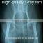 Coupon available! MSLMF02 Best seller green sensitive x ray film with CE for sale