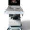 MC-DU-C5 Laptop Color Doppler Ultrasound System SonoScape 4d ultrasound promotion product