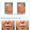 Latest technology HIFU ultrasound facial treatment equipment