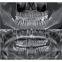 Dental 3D CBCT, Dental panoramic CBCT 3D