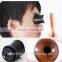 MINI computer usb skin analyzer eye scanner iridology camera with CE J013