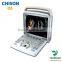 medical hospital 4d portable color Chison q5 ultrasound price