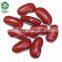 New Crop Red Kidney Beans Heilongjiang Origin