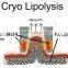 Fat Reduction Cold Body Sculpting Cryolipolyse Machine