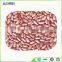 hot sale and best quality light speckle kidney beans