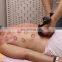 traditional chinese medicine equipment scraping machine meridian device electric cupping therapy machine