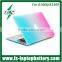 Frosted Matte Case cover for Macbook 13" 15" Rubberized Hard Case Cover For Macbook Air 11" 13"