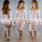Bonvatt Sexy Europe and the United States burned hole burnout hole dress