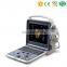 MY-A035A medical portable or trolley type full digital color doppler ultrasound scan/scanner/machine price with ultrasonic probe