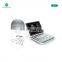 Top sale Salon equipment ultra-som portatil /portable ultrasound scanner /portable ultrasound machine for pregnancy