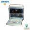 medical Chison portable 4d color ultrasound Chison q9