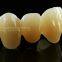 Dental Crown Multilayer Zirconia, Dental Teeth, Dental Prosthesis, Laboratoire Dentaire, Dentallabor, Laboratorio Dental, Dental Laboratory, Shenzhen LJ Dental Lab