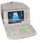 2016 Brand New Best Quality CE Approved Digital Portable Style Ultrasound Machine/Scanner For Sale with Cheap Price-Shelly