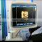 Mobile Color Doppler System 3D 4D S11 Sonoscape Echography