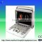 Used Portable Ultrasound Scanners.