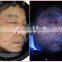 Skin scanner analyzer with Canon camera