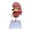 Pathological Medical Human Body Anatomy Model Kidney