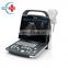 DP-20 Mindray Portable Full Digital Ultrasound Machine Price Mindray Color Ultrasound  LED