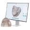 Dental 3D Scanner, Dental 3D printer