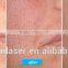 Ablative Fractional Resurfacing Laser System 8.0 Inch CO2 Laser Equipment Sun Damage Recovery