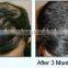 CE approved 650nm diode laser hair growth machine/hair loss therapy device