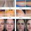 Hot sale shr hair removal 640nm/530nm/480nm filters fast hair remove beauty machine