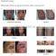 Professional Mini C6 High energy Beauty Equipment For body Rejuvenation Speckle Removal And Freckle Removal