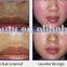 The Newest 3 Filters OPT Hair Removal IPL Machine for Skin Rejuvenation With CE Certification