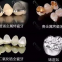Custom Zirconia Abutment Porcelain Fused to Metal Bridge Made in China Dental Lab