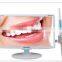 Hot Sale Dental Intra Oral Camera +18.5 Inch 3 Million-Pixel High-Definition Digital LCD