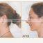 neckline slimmer /chin slimmer / chin massager