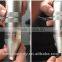 Hot Sale Q Switched Nd Yag Laser Varicose Veins Treatment Tattoo Removal Machine With CE Certificate/remove Tattoo 532nm