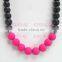 black&hot pink round silicone teething beads necklace safety copper teething necklace teething Baby TN054