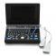 CE Approved Laptop PC platform 3D image Ultrasound Machine/Scanner with 3.5Mhz Convex probe