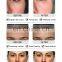 Professional11 in 1 microdermabrasion deep cleaning aqua peeling skin rejuvenation care facial machine