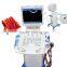2015 Promote Trolley Mobile Type Ultrasound Scanner RUS-9000C With Convex Micro-convex linear rectal transvaginal probe optional