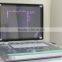 Ultrasound scanner, Ultrasound machine for pregnancy with portable ultrasound scanner MSLPU25W