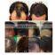 korean alopecia rogaine hair regrowth horse hair growth tonic laser system machine instrements therapy equipment in pakistan