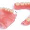 China Full Acrylic Denture Flipper Complete Denture Dental Supply Dental Crown Dental Unit Denture Orthodontic Products Dental Products