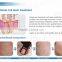 2016 Lowest Distributor price: super pulse co2 laser for skin refreshing scar remov for Acne Scars Treatment , Burn Debridement
