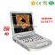Cheapest price MY-A024B-N Medical Portable Digital 4D Color Doppler Ultrasound Machine with CW function