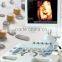 MC-DU-iVis30 Live 3D 4D Color Doppler Ultrasound Machine
